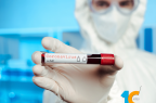Coronavirus-LVN-77