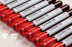 COVID19-LVN